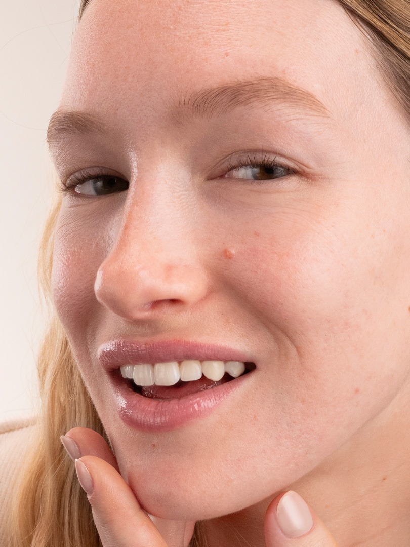 Piel mixta con acne